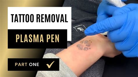 plasma on tattoo|What Happens If You Donate Plasma After Getting A Tattoo